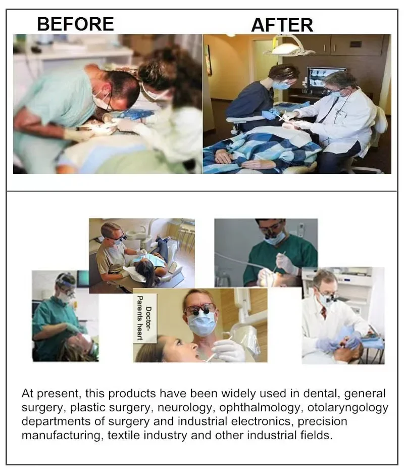 Fogászat Binokuláris orvosi nagyító 2,5X 3,5X ultrakönnyű optikai nagyítólencse 320-540mm nagyító fogászati sebészethez Kép 4